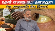 மஞ்சள் காமாலை சித்த மருத்துவத்தில் குணமாகுமா? ஆண்களுக்கு ஏன் அதிக பாதிப்பு?