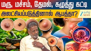 மரு, மச்சம், தேமல், கழுத்து கட்டிகளை அலட்சியப்படுத்தினால் ஆபத்தா?