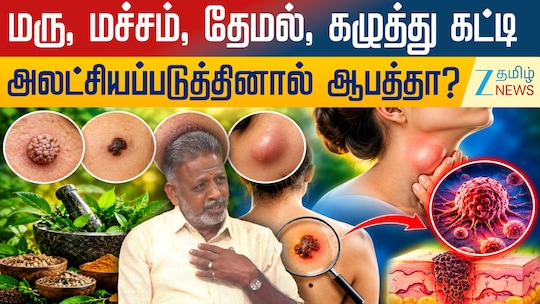 மரு, மச்சம், தேமல், கழுத்து கட்டிகளை அலட்சியப்படுத்தினால் ஆபத்தா?