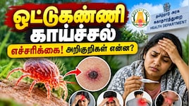 ஒட்டுண்ணி காய்ச்சல் அறிகுறிகள் என்ன? தற்காத்துக் கொள்வது எப்படி? – சுகாதாரத்துறை எச்சரிக்கை