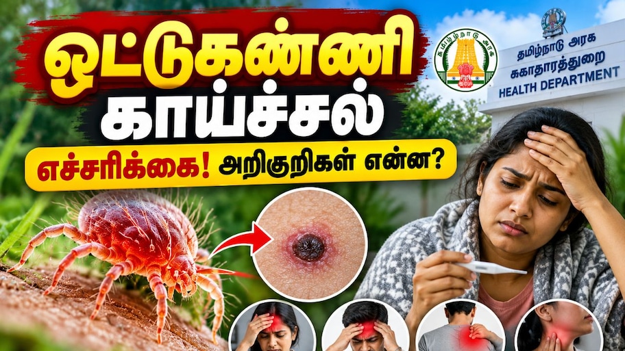 ஒட்டுண்ணி காய்ச்சல் அறிகுறிகள் என்ன? தற்காத்துக் கொள்வது எப்படி? – சுகாதாரத்துறை எச்சரிக்கை