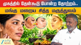 முகத்தில் தேன்கூடு போன்ற தோற்றம்.. மங்கு மறைய உதவும் சித்த மருத்துவம்