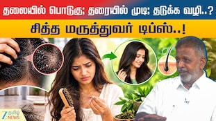 தலையில் பொடுகு; தரையில் முடி; தடுக்க வழி..? சித்த மருத்துவர் டிப்ஸ்..!